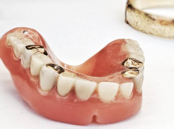 Chrome Metal Dentures in Redditch