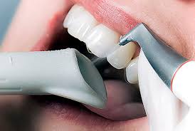 Air polishing in Redditch