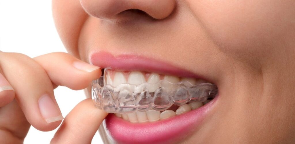 Invisalign in Redditch