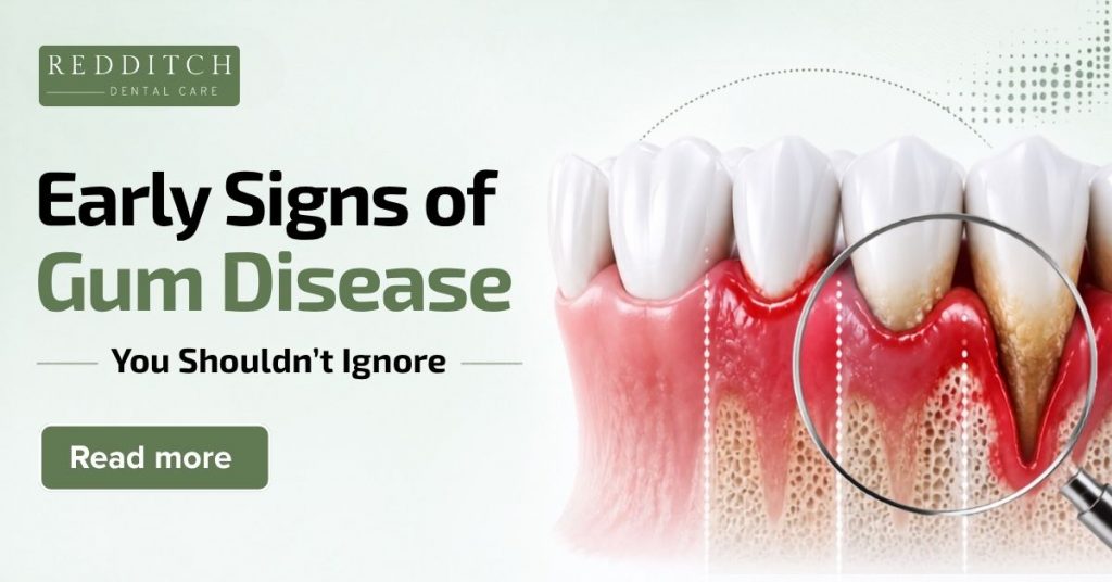 Early Signs of Gum Disease You Shouldn’t Ignore