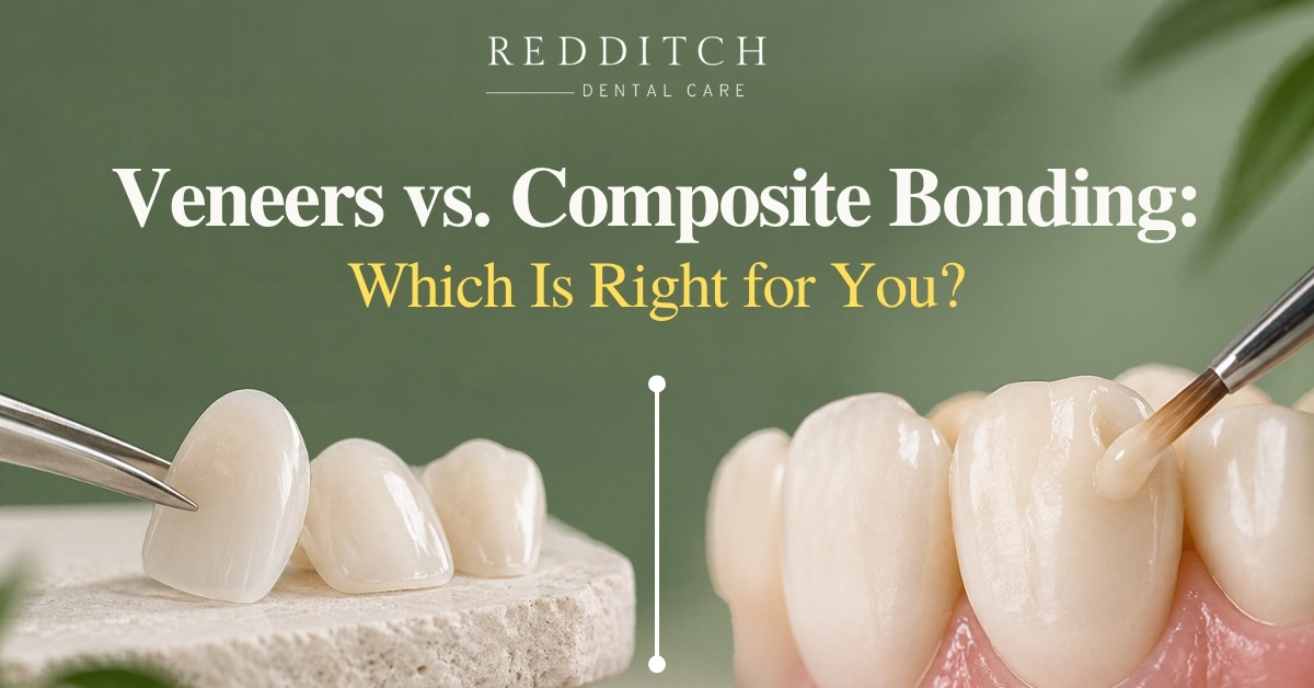 Veneers vs. Composite Bonding: Which Is Right for You?