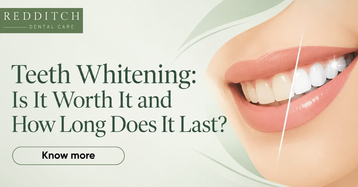 Teeth Whitening: Is It Worth It and How Long Does It Last?